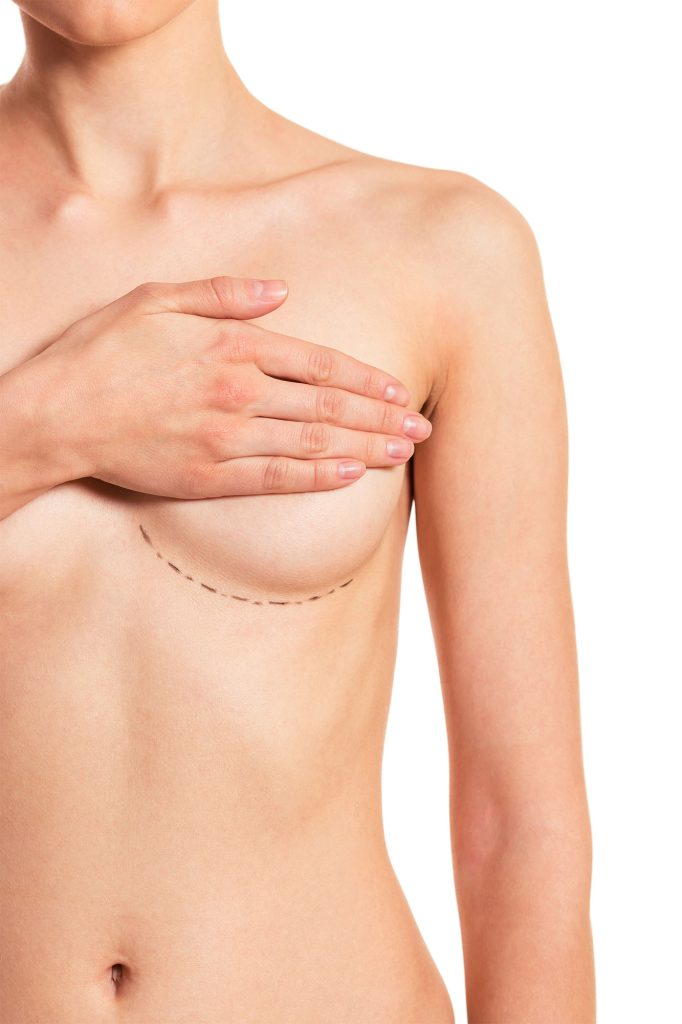A woman covering her breast posing as a model for breast reconstruction.