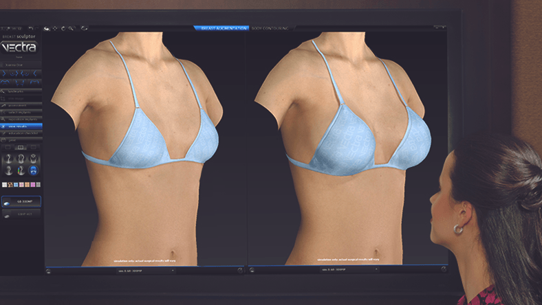 Try the breast augmentation simulator on a body similar to yours