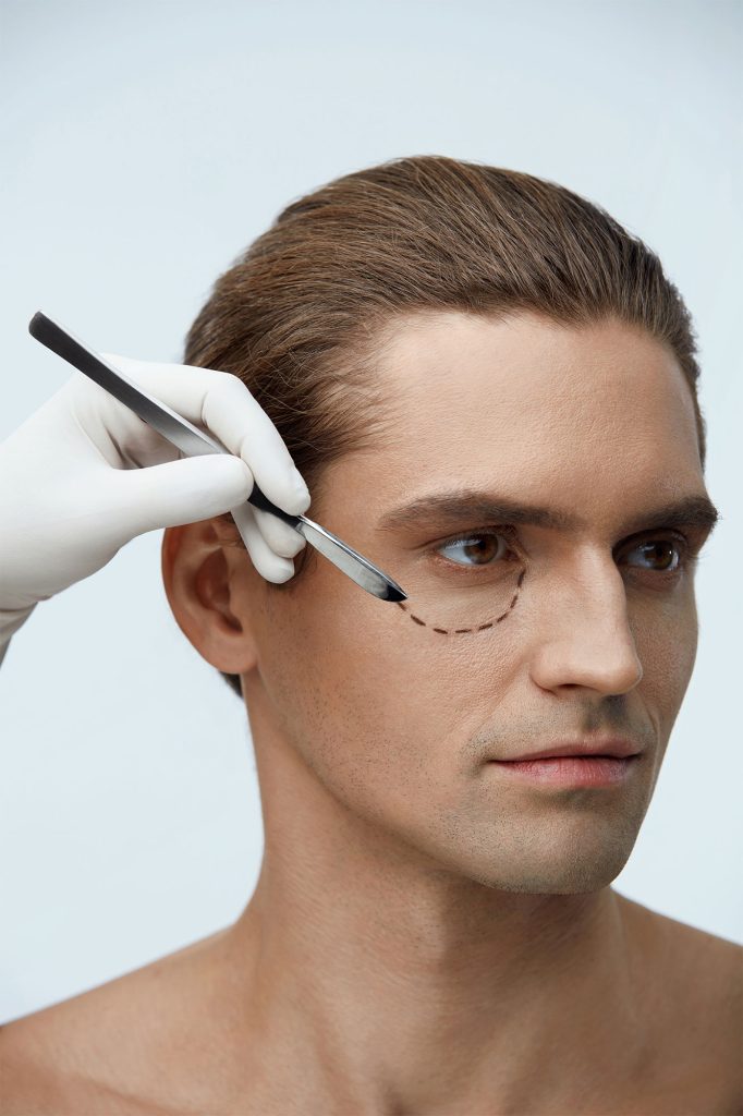 male model showing us incision for eyelift