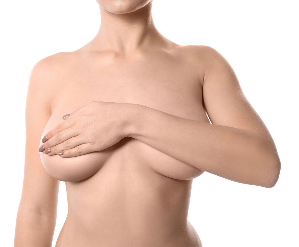 Front view of a woman posing as a model for breast implant removal.